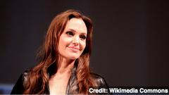 Angelina Jolie's Mastectomy Raises Questions About Screening
