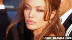 Angelina Jolie Will Have More Surgeries: What's Next